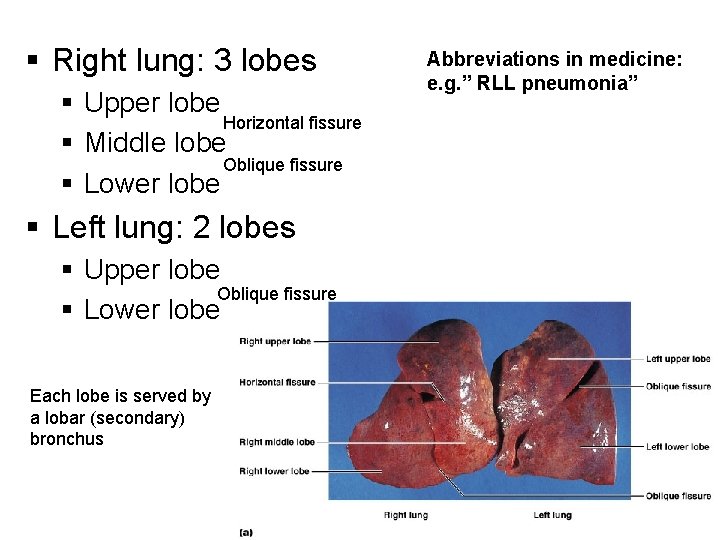 § Right lung: 3 lobes § Upper lobe Horizontal fissure § Middle lobe Oblique § Right lung: 3 lobes § Upper lobe Horizontal fissure § Middle lobe Oblique