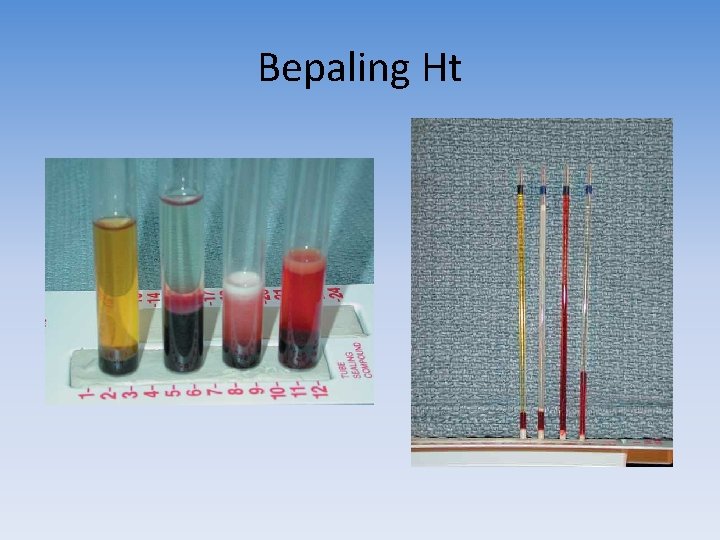 Bepaling Ht 