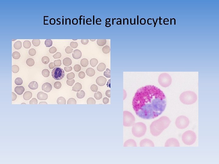 Eosinofiele granulocyten 