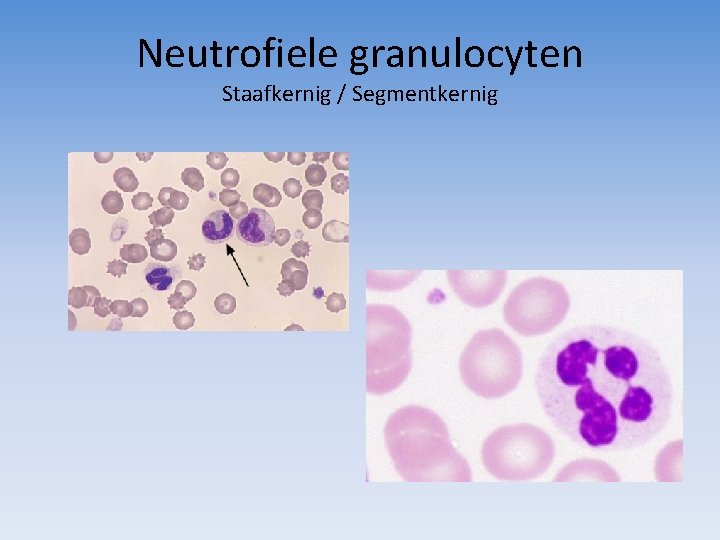 Neutrofiele granulocyten Staafkernig / Segmentkernig 