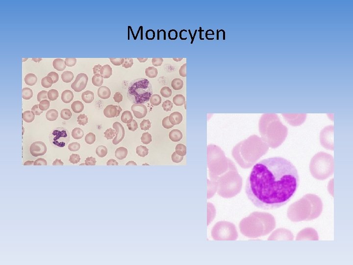 Monocyten 