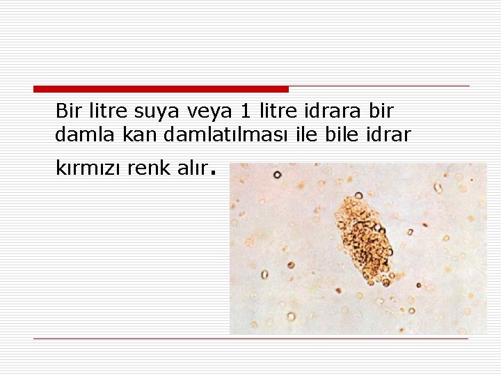 Bir litre suya veya 1 litre idrara bir damla kan damlatılması ile bile idrar