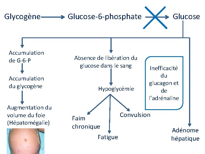  Glycogène Glucose-6 -phosphate Glucose Accumulation de G-6 -P Accumulation du glycogène Augmentation du