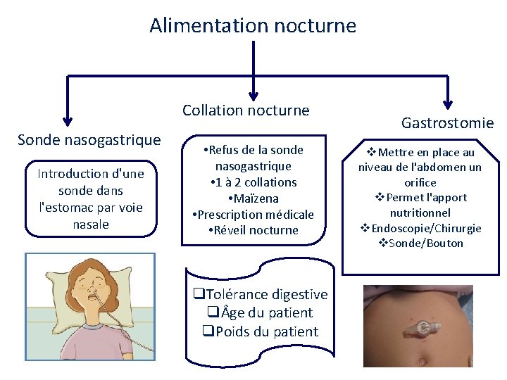 Alimentation nocturne Collation nocturne Sonde nasogastrique Introduction d'une sonde dans l'estomac par voie nasale