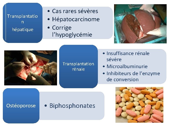 Transplantatio n hépatique • Cas rares sévères • Hépatocarcinome • Corrige l’hypoglycémie Transplantation rénale