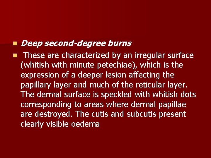 n Deep second-degree burns n These are characterized by an irregular surface (whitish with