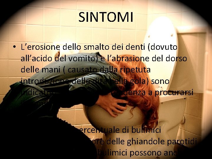 SINTOMI • L’erosione dello smalto dei denti (dovuto all’acido del vomito) e l’abrasione del