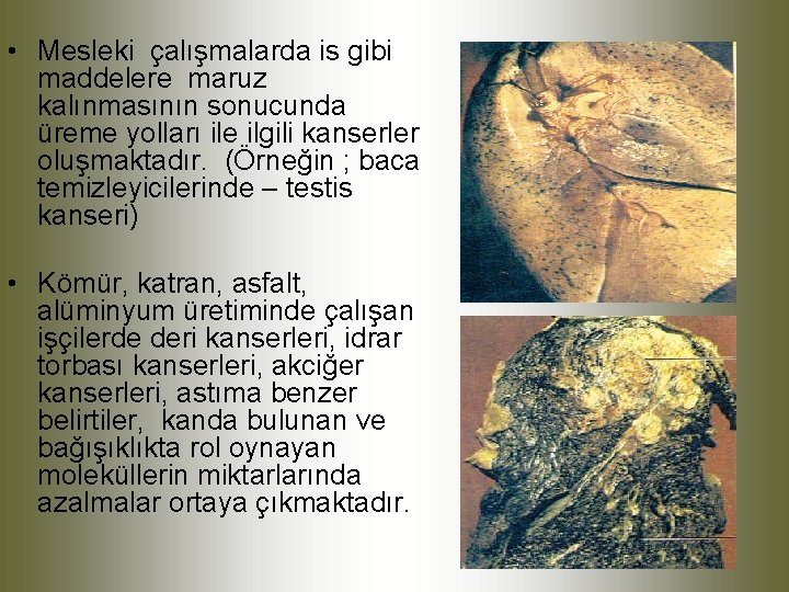  • Mesleki çalışmalarda is gibi maddelere maruz kalınmasının sonucunda üreme yolları ile ilgili