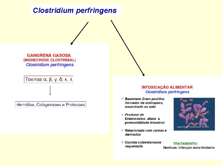 Clostridium perfringens 