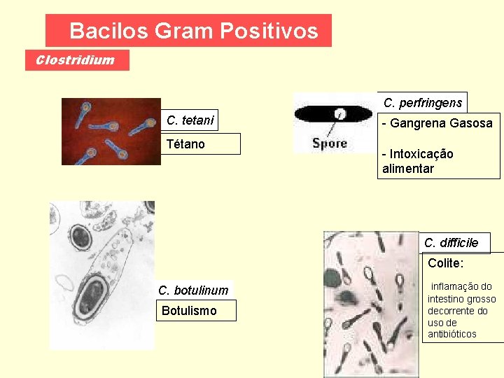 Bacilos Gram Positivos Clostridium C. perfringens C. tetani Tétano - Gangrena Gasosa - Intoxicação