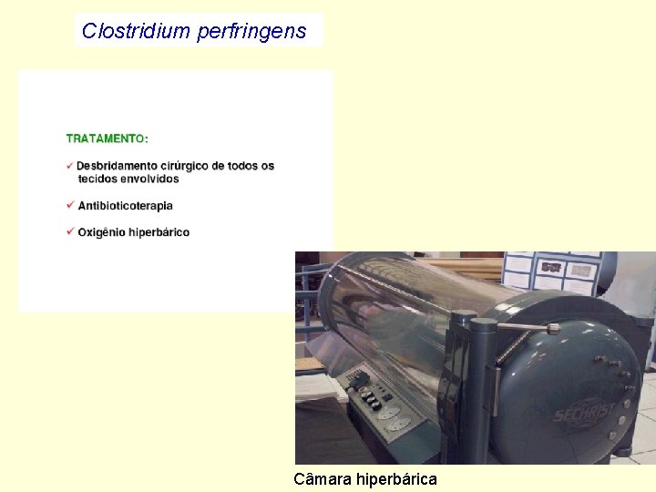 Clostridium perfringens Câmara hiperbárica 