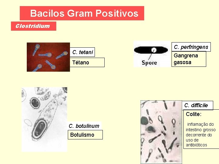 Bacilos Gram Positivos Clostridium C. tetani Tétano C. perfringens Gangrena gasosa C. difficile Colite: