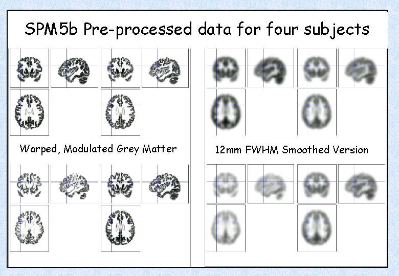 SPM 5 b Pre-processed data for four subjects Warped, Modulated Grey Matter 12 mm