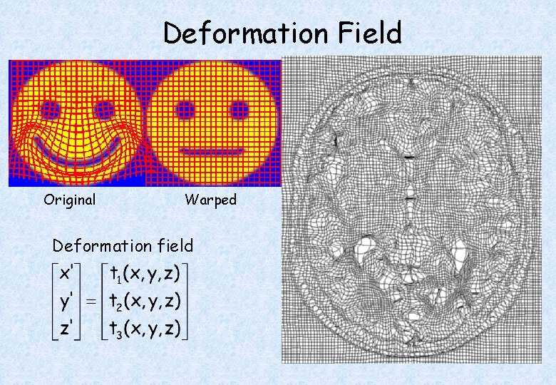 Deformation Field Original Warped Deformation field Template 