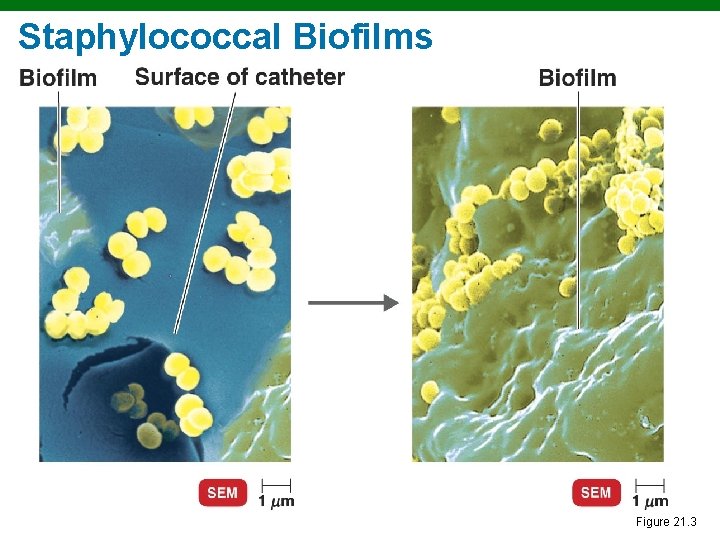 Staphylococcal Biofilms Figure 21. 3 Staphylococcal Biofilms Figure 21. 3