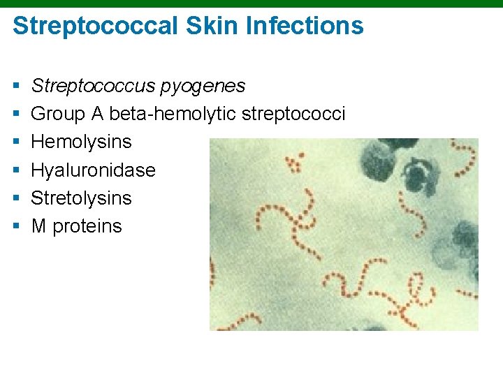 Streptococcal Skin Infections § § § Streptococcus pyogenes Group A beta-hemolytic streptococci Hemolysins Hyaluronidase