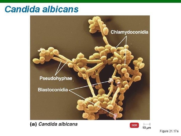 Candida albicans Figure 21. 17 a 