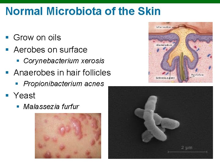 Normal Microbiota of the Skin § Grow on oils § Aerobes on surface § Normal Microbiota of the Skin § Grow on oils § Aerobes on surface §