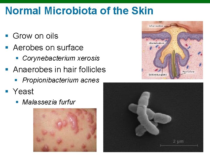 Normal Microbiota of the Skin § Grow on oils § Aerobes on surface §