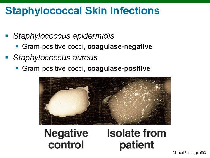 Staphylococcal Skin Infections § Staphylococcus epidermidis § Gram-positive cocci, coagulase-negative § Staphylococcus aureus §