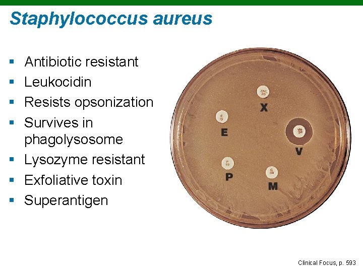 Staphylococcus aureus § § Antibiotic resistant Leukocidin Resists opsonization Survives in phagolysosome § Lysozyme