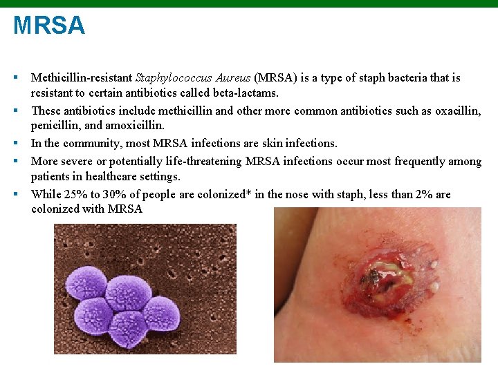 MRSA § § § Methicillin-resistant Staphylococcus Aureus (MRSA) is a type of staph bacteria