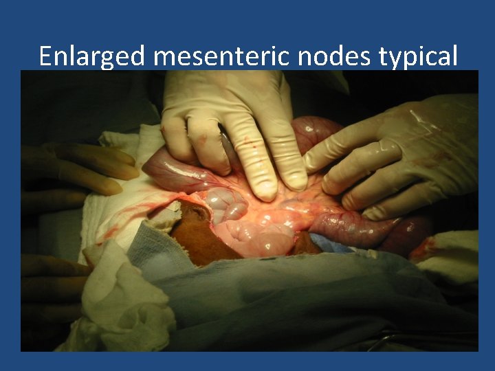 Enlarged mesenteric nodes typical 