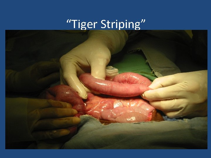 “Tiger Striping” 
