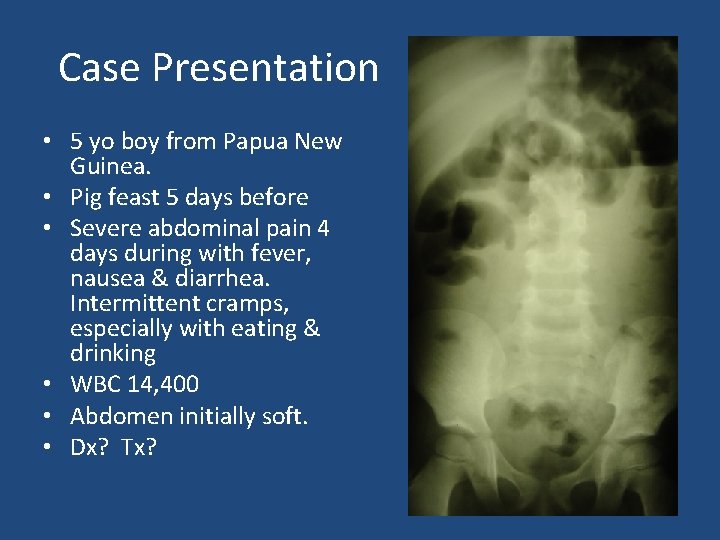 Case Presentation • 5 yo boy from Papua New Guinea. • Pig feast 5