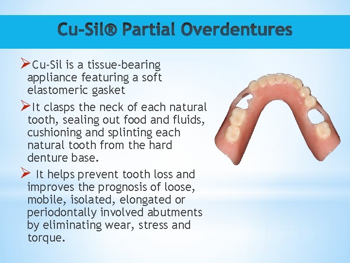 ØCu-Sil is a tissue-bearing appliance featuring a soft elastomeric gasket ØIt clasps the neck