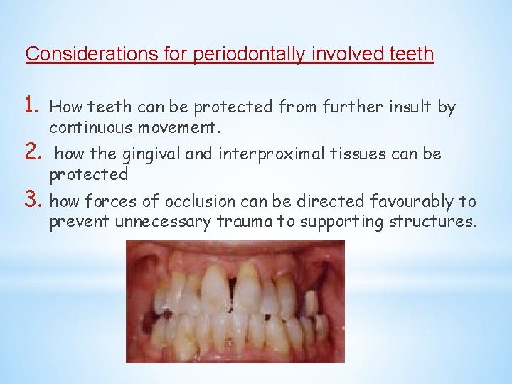 Considerations for periodontally involved teeth 1. 2. How teeth can be protected from further