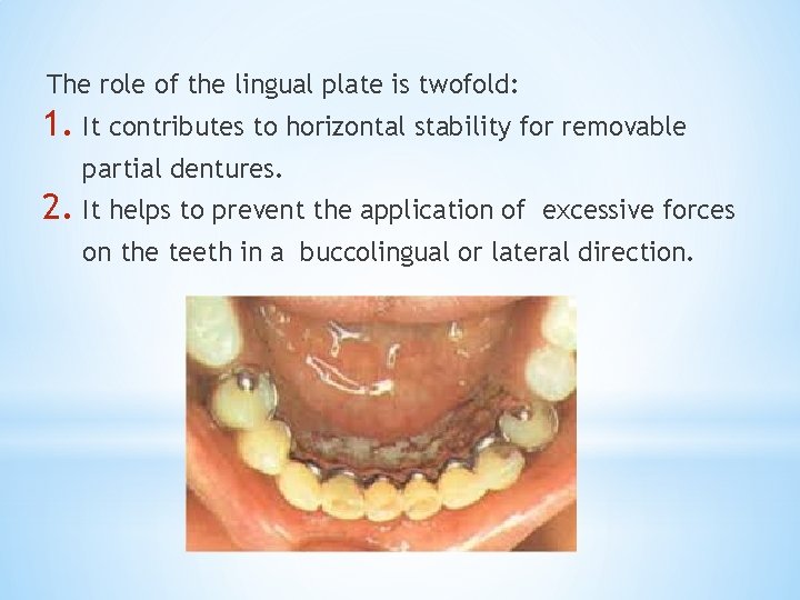 The role of the lingual plate is twofold: 1. It contributes to horizontal stability