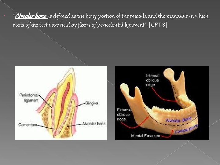  “Alveolar bone is defined as the bony portion of the maxilla and the