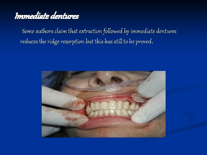 Immediate dentures: Some authors claim that extraction followed by immediate dentures reduces the ridge