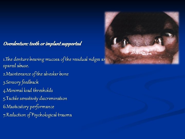 Overdenture: tooth or implant supported 1. The denture bearing mucosa of the residual ridges