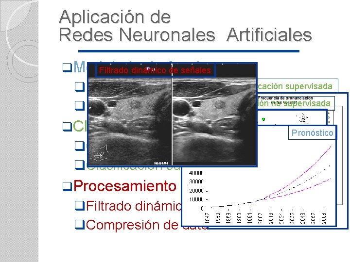 Aplicación de Redes Neuronales Artificiales q. Modelado de funciones Filtrado dinámico de señales q.