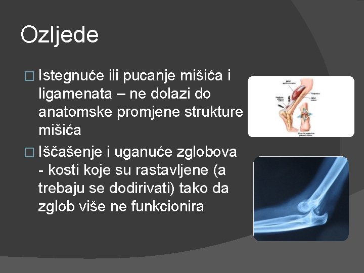 Ozljede � Istegnuće ili pucanje mišića i ligamenata – ne dolazi do anatomske promjene