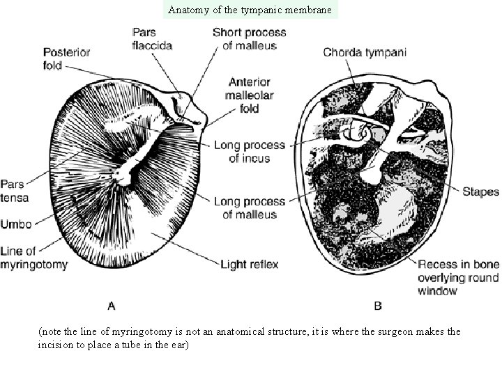 Anatomy of the tympanic membrane (note the line of myringotomy is not an anatomical