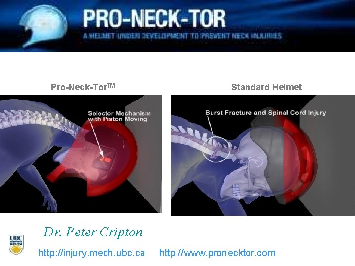 Pro-Neck-Tor. TM Standard Helmet Dr. Peter Cripton http: //injury. mech. ubc. ca http: //www.