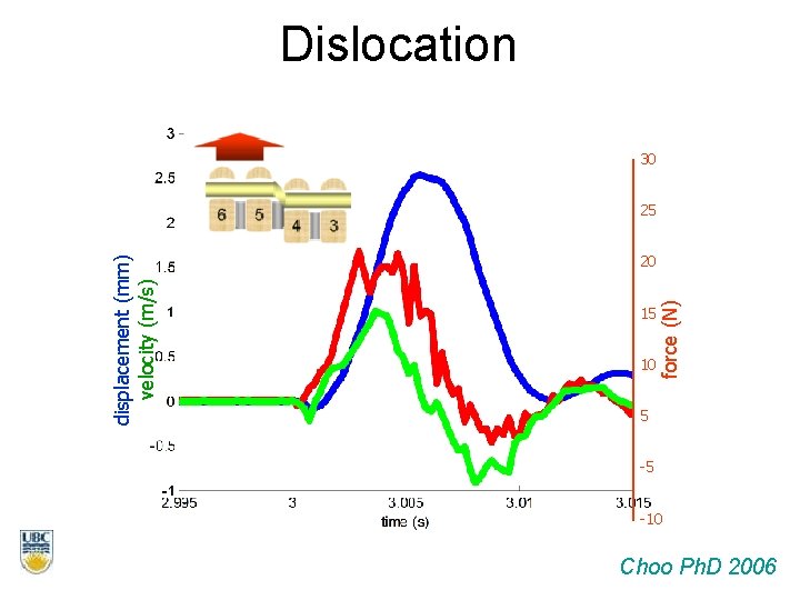 Dislocation 30 20 15 10 force (N) displacement (mm) velocity (m/s) 25 5 -5