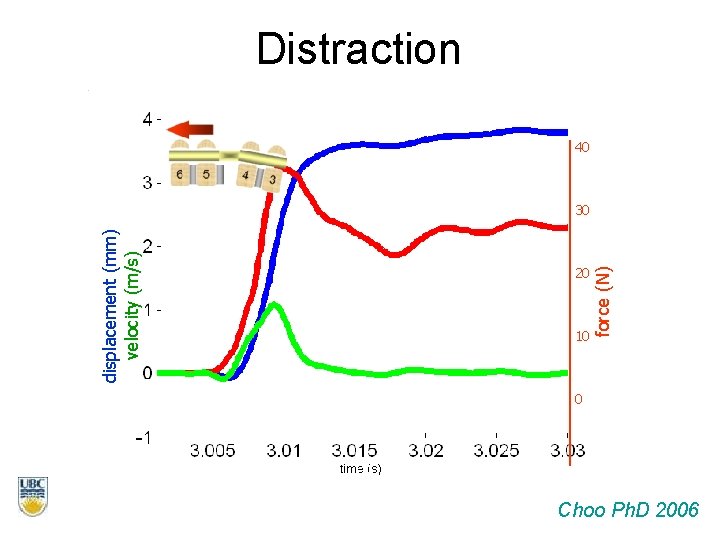 displacement (mm) velocity (m/s) 20 10 force (N) Distraction 40 30 0 Choo Ph.