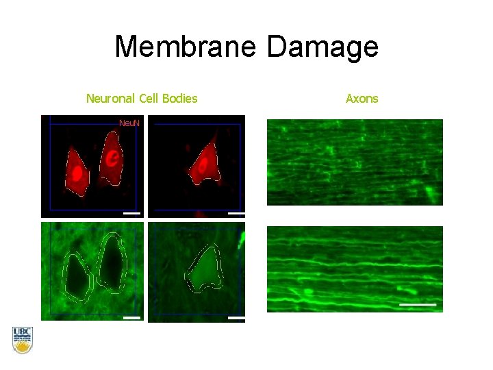 Membrane Damage Neuronal Cell Bodies Neu. N Axons 