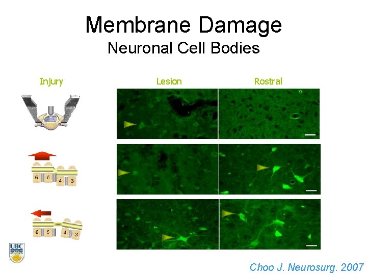 Membrane Damage Neuronal Cell Bodies Injury Lesion Rostral Choo J. Neurosurg. 2007 