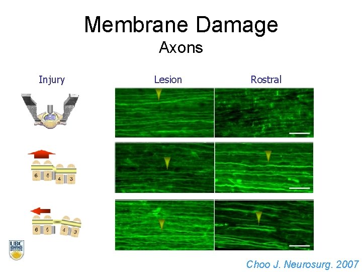 Membrane Damage Axons Injury Lesion Rostral Choo J. Neurosurg. 2007 