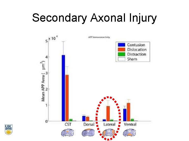 Secondary Axonal Injury 