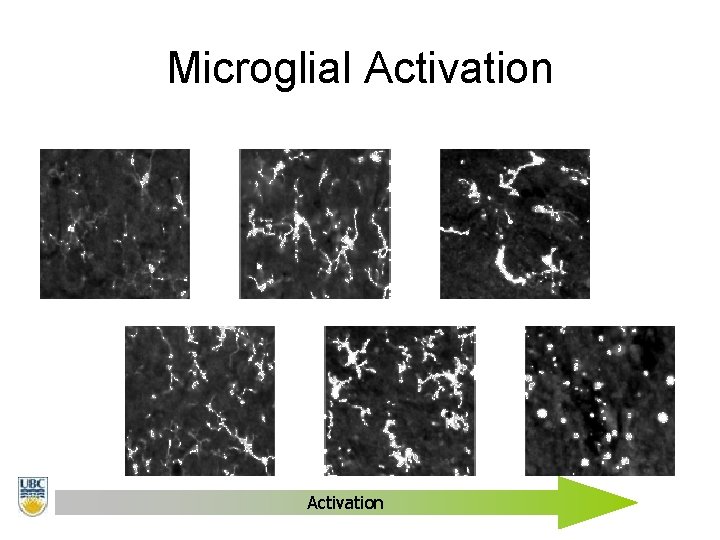 Microglial Activation 