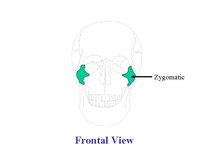 Zygomatic Frontal View 