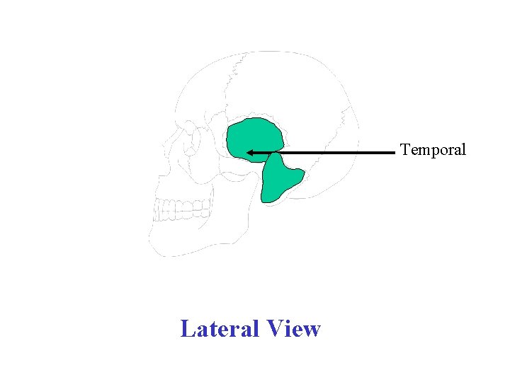 Temporal Lateral View 