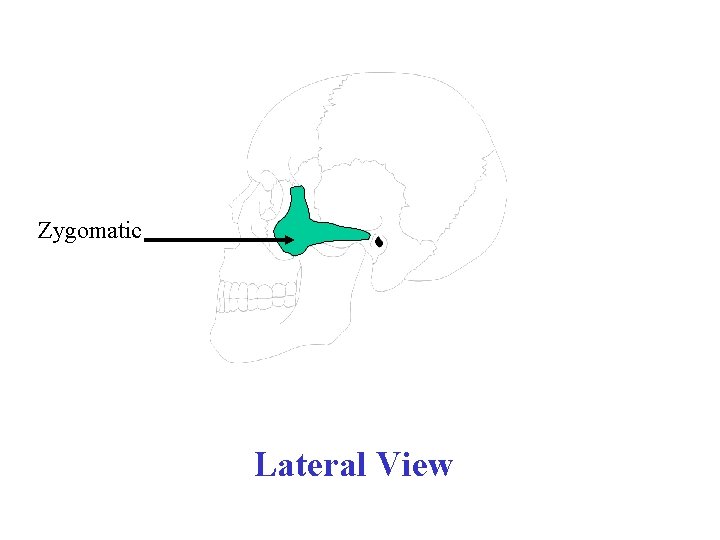 Zygomatic Lateral View 