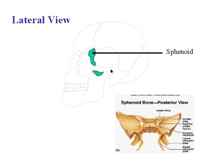 Lateral View Sphenoid 